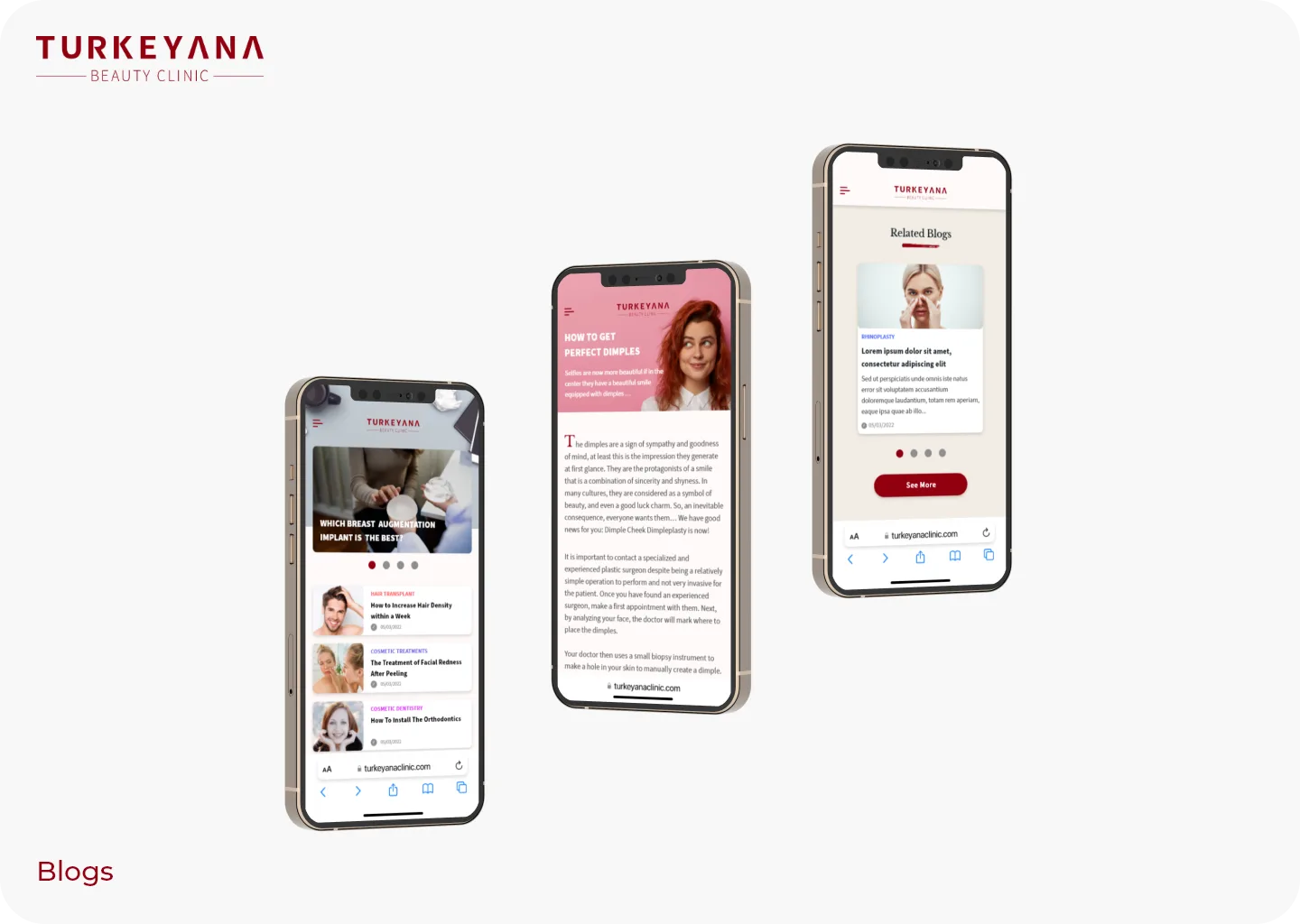 Turkeyana Redesign screen